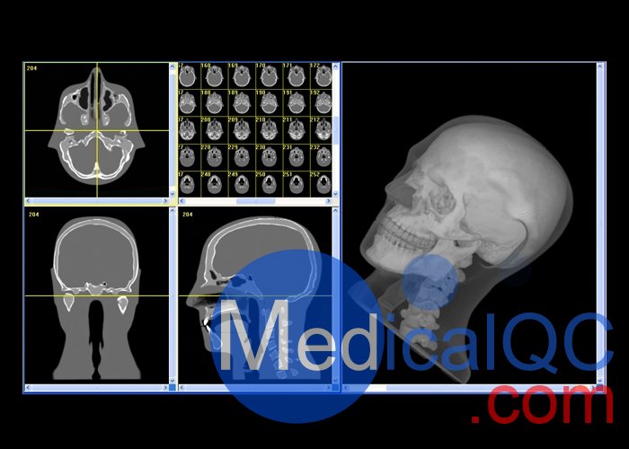CIRS 711-HN頭部模體，CIRS 711-HN CBCT模體