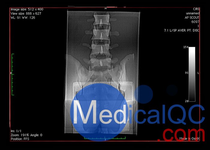 CIRS 034腰椎模體，CIRS 034穿刺訓(xùn)練模體
