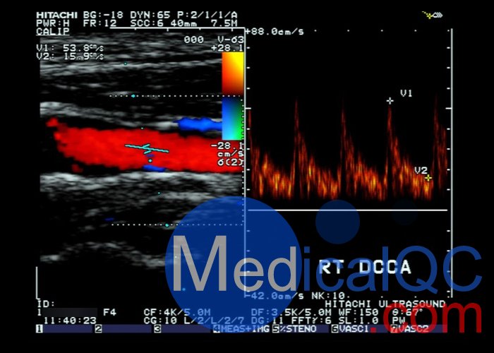 CIRS 043多普勒模體，CIRS 043 Mark 4多普勒超聲模體