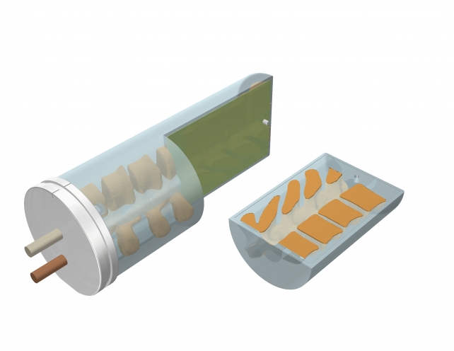 CIRS 036-01 E2E SBRT胸部模體，脊椎可移動