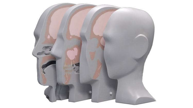 CIRS 731-HN頭部劑量模體，CIRS 731-HN頭部模體