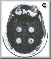 RSD RS-250 頭部CT模體，RS-250頭部彷真CT模體