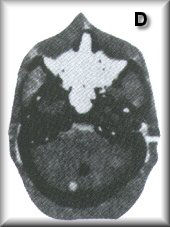RSD RS-250 頭部CT模體，RS-250頭部彷真CT模體