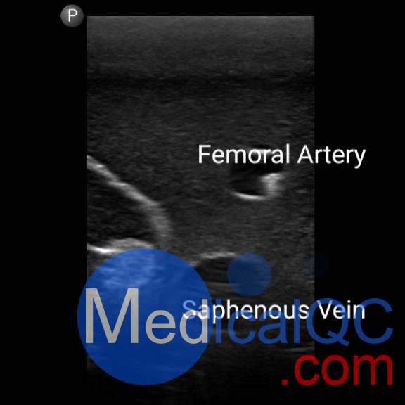 BPF1500-HP血管通路和區(qū)域麻醉超聲訓(xùn)練模體，BPF1500-HP區(qū)域麻醉超聲模體