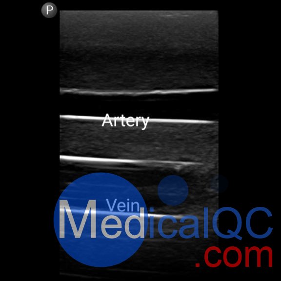BPF1500-HP血管通路和區(qū)域麻醉超聲訓(xùn)練模體，BPF1500-HP區(qū)域麻醉超聲模體