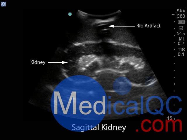 BPRB-2011腎活檢超聲訓練模型,BPRB-2011腎活檢模體