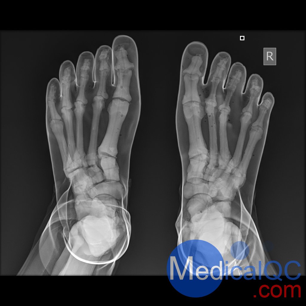 AR10A全身X射線照相定位模體，AR10A全身模體，AR10A X射線成像模體