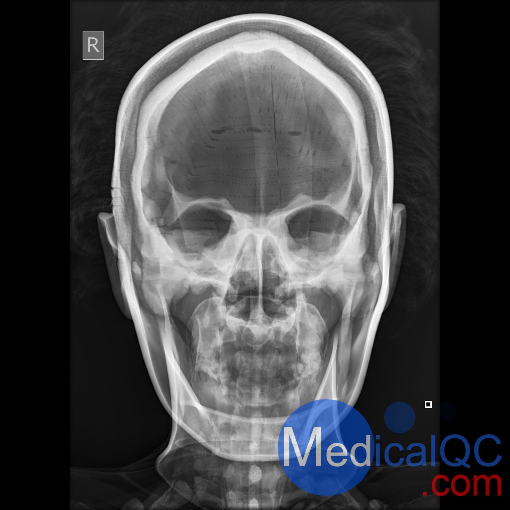 AR10A全身X射線照相定位模體，AR10A全身模體，AR10A X射線成像模體
