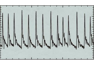 Multi+ 可變波形軟件，心律失常