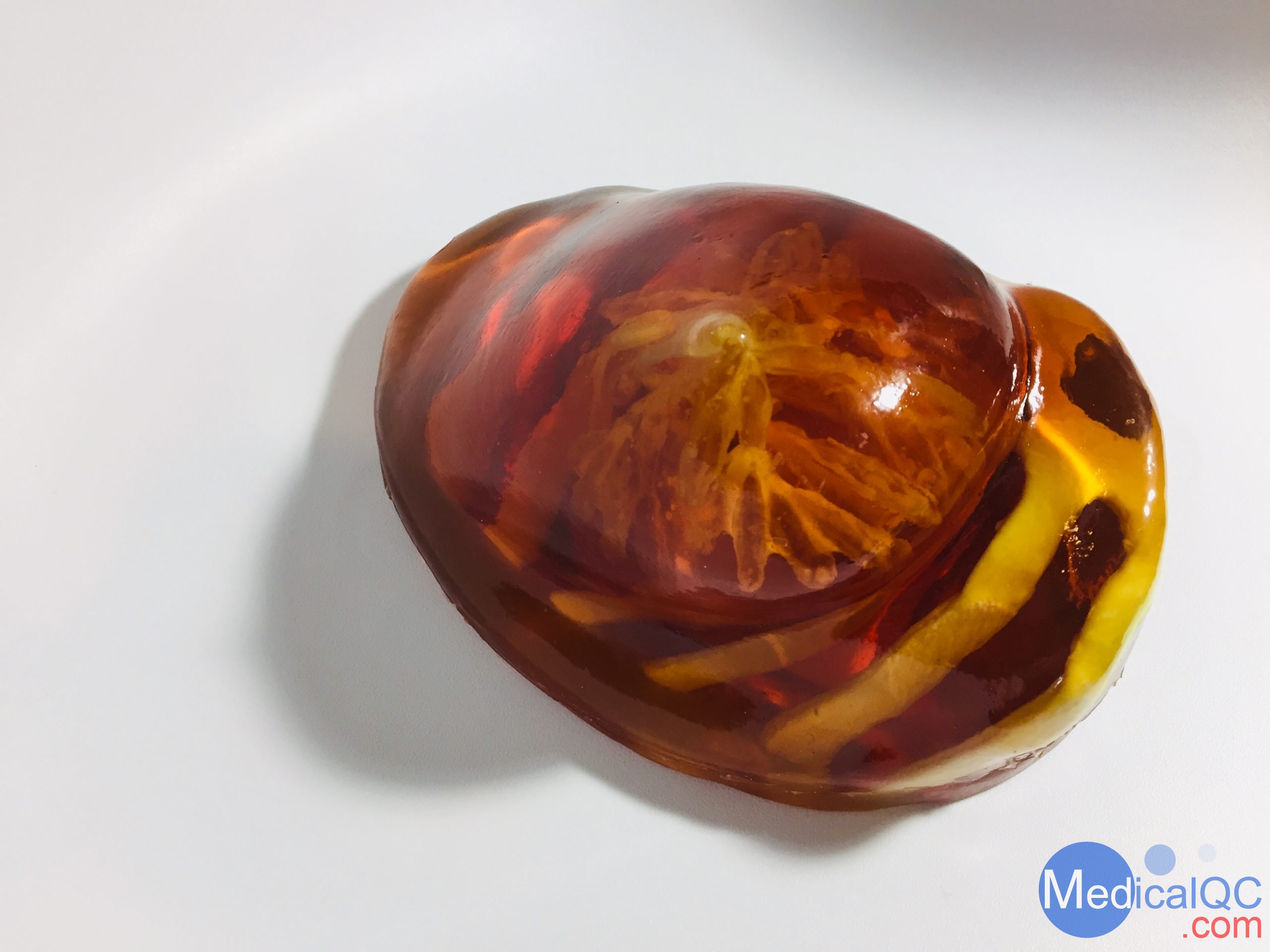 BT-A01乳房模體，BT-A01解剖乳房模體，Breast Phantom