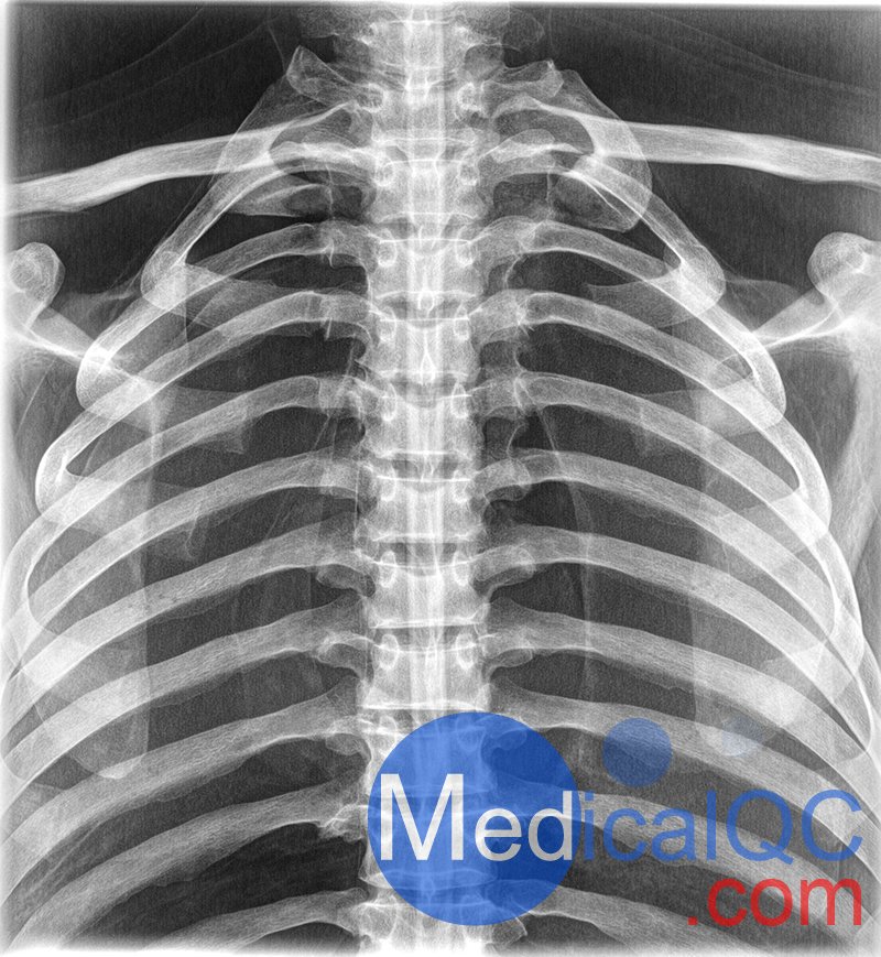 EZ7400真人骨胸部模體，EZ7400 X射線胸部模體