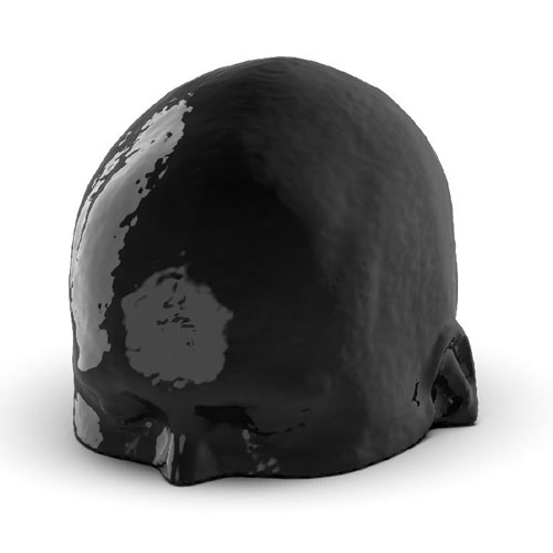 WEK50-04 CTA頭模，帶AVM CTA頭模，WEK50-04 CT血管造影頭模