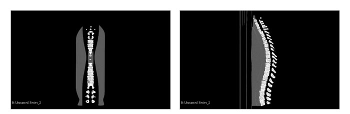 SE-A02成人脊柱模型，SE-A02脊柱模體,SE-A02脊椎模體CT掃描成像