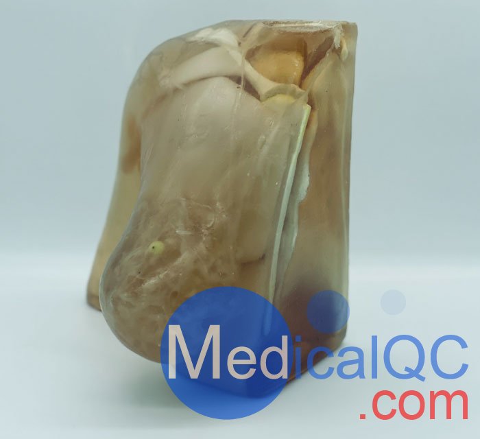 BT-A02乳腺模體,BT-A02成人乳腺模型產(chǎn)品實(shí)拍圖