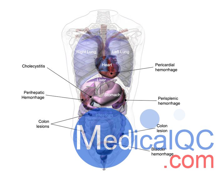 US-A04 FAST訓(xùn)練軀干模體，US-A04超聲軀干模體