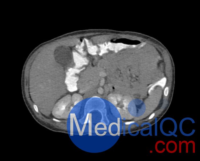 WEK58-03兒童軀干模型，WEK58-03兒童軀干模體成像效果圖