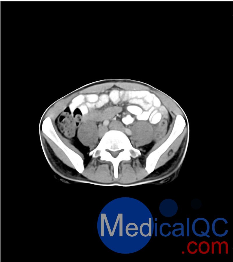 WEK-5501男性腹部模體，WEK-5501男性骨盤模體